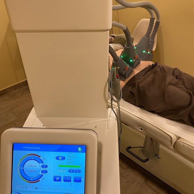 نظام النحت بالليزر ديود بادي