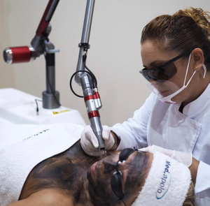 نظام الليزر Q-Switched Nd Yag